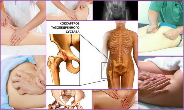 Массаж тазобедренного сустава и ягодичной области при артрозе, коксартрозе