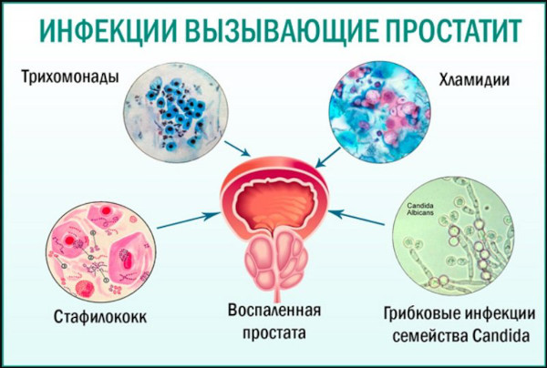 Обезболивающие при простатите у мужчин. Что делать, если болит простата