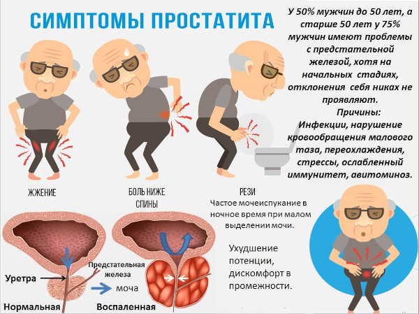 Обезболивающие при простатите у мужчин. Что делать, если болит простата