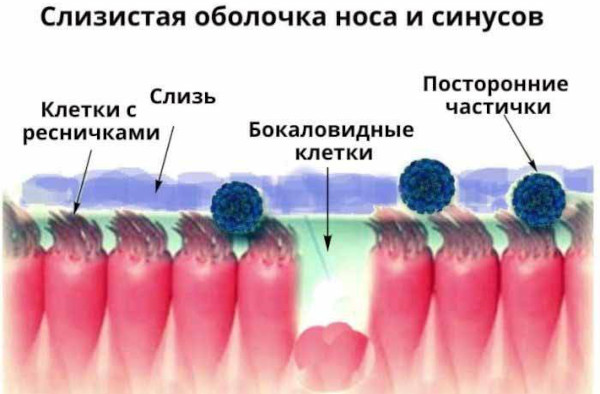 Пневматизация пазух носа. Что это, что значит сохранена, снижение придаточных верхнечелюстных пазух