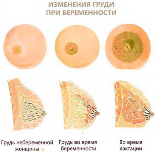 Большие соски и крупные ареолы груди у девушек. Причины