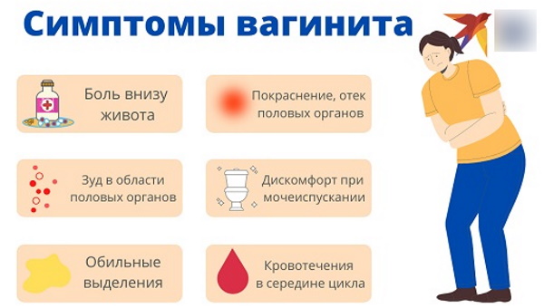 Полип в мочевом пузыре у женщин. Что это, симптомы, лечение