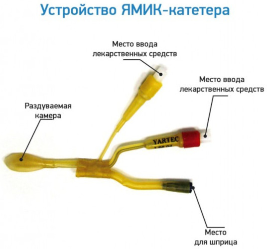 Синус-катетер ЯМИК. Инструкция по применению, цена, отзывы