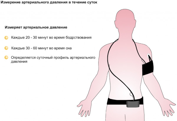 Суточное мониторирование АД (артериального давления). Цена, аппараты