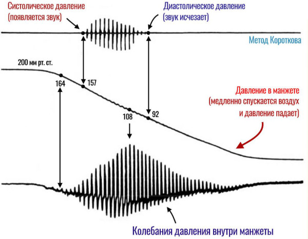 Суточное мониторирование АД (артериального давления). Цена, аппараты