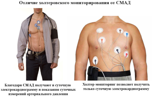 Суточное мониторирование АД (артериального давления). Цена, аппараты