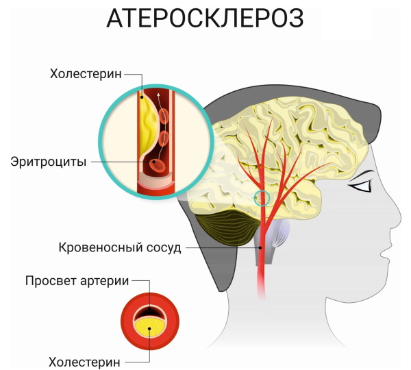 Витафон. Отзывы врачей, пользователей, противопоказания