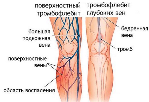 Витафон. Отзывы врачей, пользователей, противопоказания