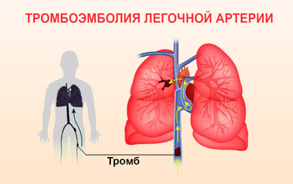 Боли в молочной железе слева у женщин. Причины