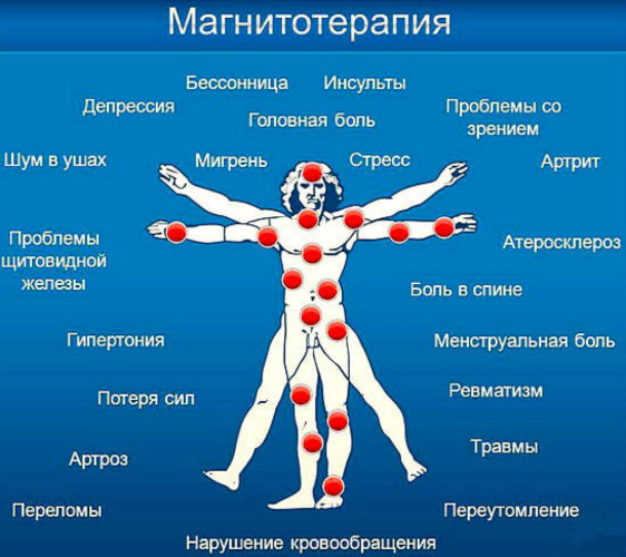 Физиотерапия (ФТЛ). Что это такое в медицине, физиопроцедуры, физиолечение