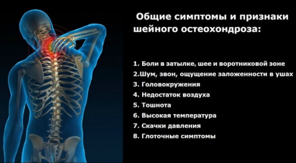 Остеохондроз: степени 1-2-3, стадии, виды, классификация по периодам