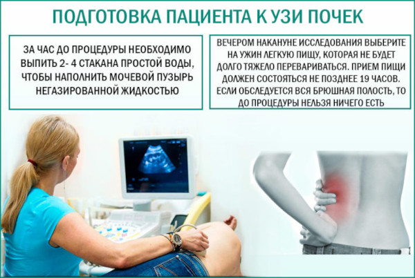 Почему моча желтая, ярко желтого лимонного цвета у женщин. Причины