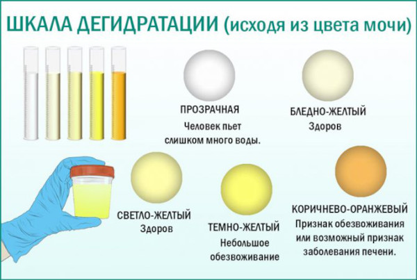 Почему моча желтая, ярко желтого лимонного цвета у женщин. Причины