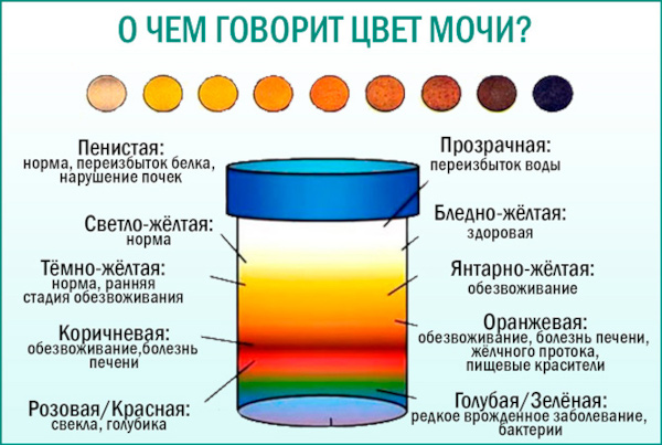 Почему у ребенка ярко желтая моча