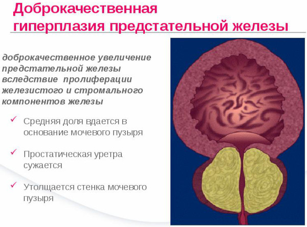 Подтекание мочи у мужчин после мочеиспускания. Причины и лечение