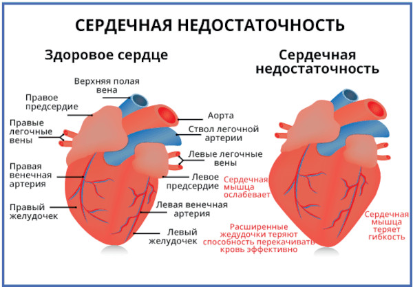 Точки для снижения давления, массаж при гипертонии, высоком давлении