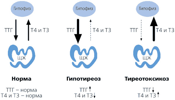ТТГ низкий Т4 высокий. Диагноз, что это значит, как лечить