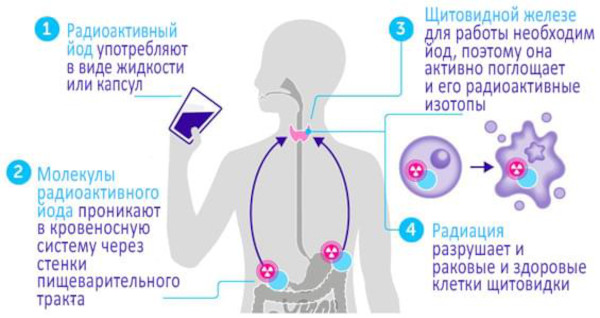 ТТГ низкий Т4 высокий. Диагноз, что это значит, как лечить