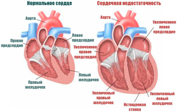 Закаливание организма: местные виды, как правильно закаляться, все способы