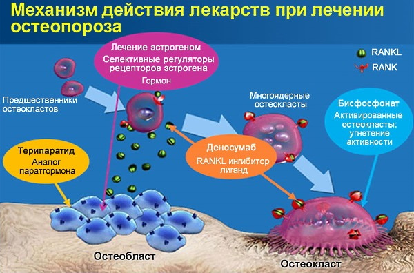 Бисфосфонаты от остеопороза. Названия препаратов, цена, инструкция