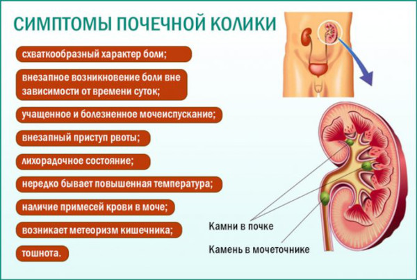 Боли в пояснице при цистите. Как, сколько болит у женщин, что делать