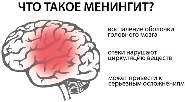 Cинусит и гайморит: разница воспаления носовых пазух, симптомы