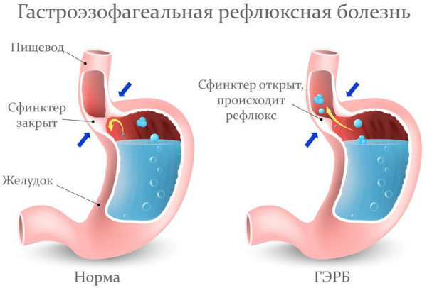 Гастроэнтерология. Что это в медицине, что лечит, заболевания