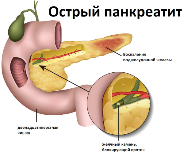 Гастроэнтерология. Что это в медицине, что лечит, заболевания