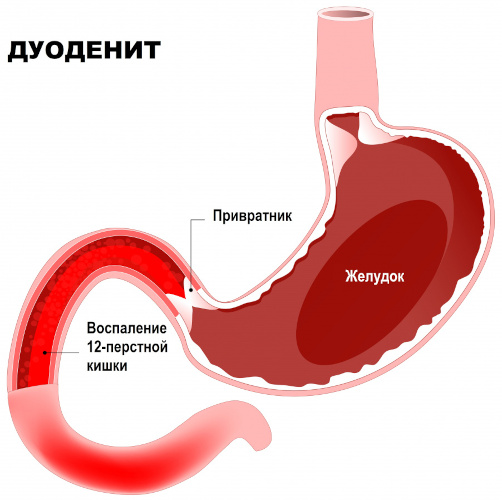 Гастроэнтерология. Что это в медицине, что лечит, заболевания