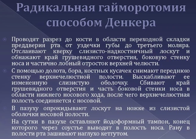 Гайморотомия эндоскопическая и радикальная. Что это такое