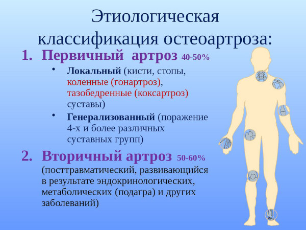 Генерализованный остеоартроз. Что это такое, как лечить