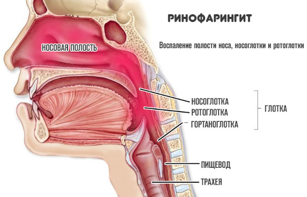 Гнойные выделения из носа, желтые густые сопли, запах гноя. Чем лечить