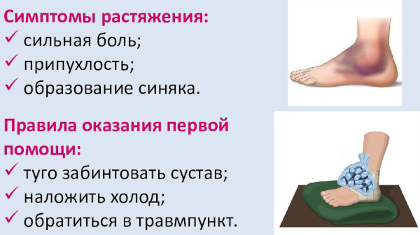 Как определить вывих или растяжение, как отличить травму плеча, стопы, связок, колена, запястья, ноги