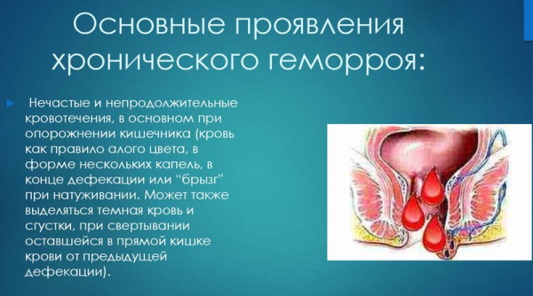 Как понять, что у тебя геморрой. Симптомы внутреннего геморроя, температура