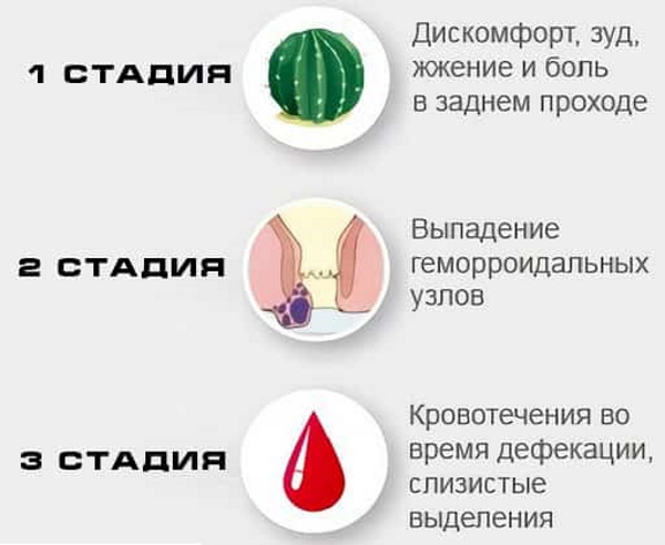 Как понять, что у тебя геморрой. Симптомы внутреннего геморроя, температура