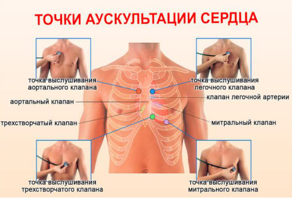 Кинкинг (извитость) позвоночных артерий. Что это, симптомы и лечение