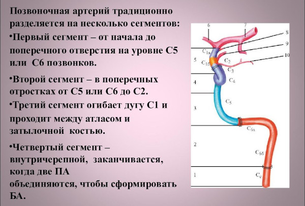 Кинкинг (извитость) позвоночных артерий. Что это, симптомы и лечение