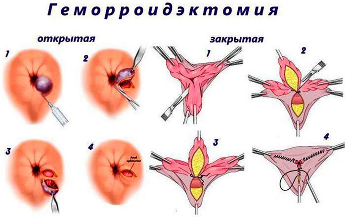 Колопроктолог кто это, что лечит. Колопроктология что это такое