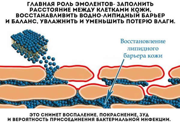 Лечение кожных заболеваний: препараты, мази-антибиотики, народные средства