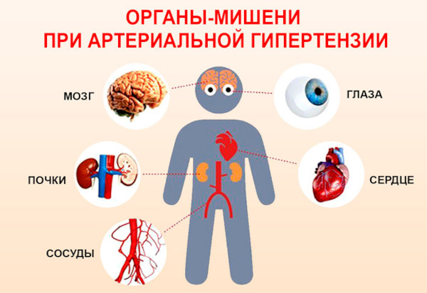 Органы мишени при гипертонической болезни артериальная гипертензия. Признаки поражения