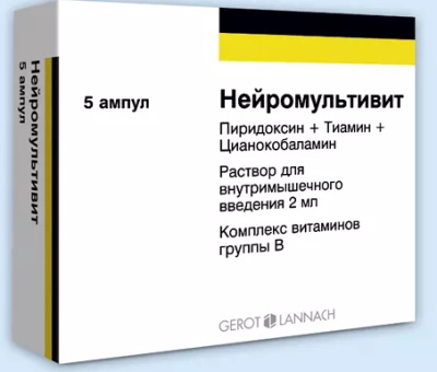 Остеоартроз позвоночника (артроз поясничного отдела). Что это такое, симптомы, лечение