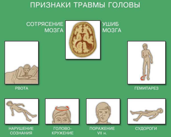 Признаки ушиба конечности. Диагностика, как определить ушиб, первая помощь