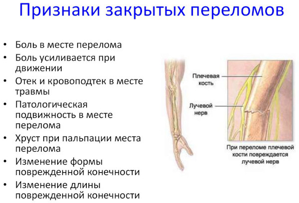 Признаки ушиба конечности. Диагностика, как определить ушиб, первая помощь