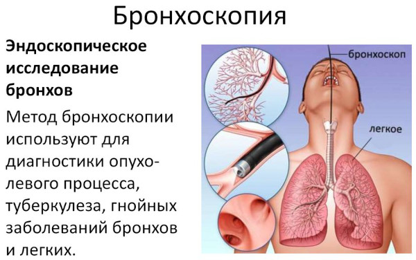 Пульмонология. Что это такое, что лечит и как, что за отделение