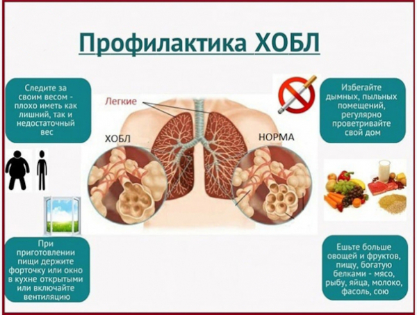 Пульмонология. Что это такое, что лечит и как, что за отделение