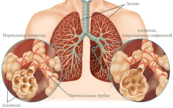 Пульмонология. Что это такое, что лечит и как, что за отделение