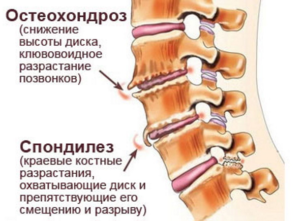 Шейный отдел позвоночника: шейные позвонки человека, строение, анатомия