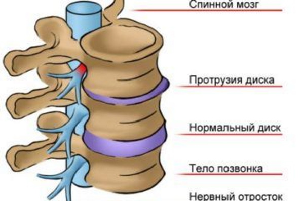 Шейный отдел позвоночника: шейные позвонки человека, строение, анатомия