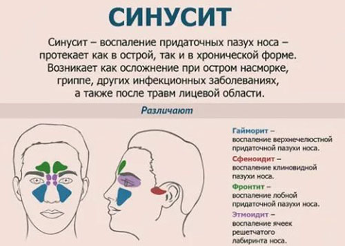 Температура при синусите у ребенка, взрослого, 37 долгое время