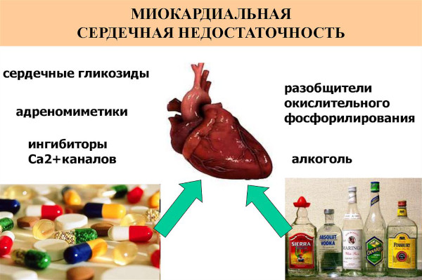 Виды сердечной недостаточности. Классификация по механизмам возникновения